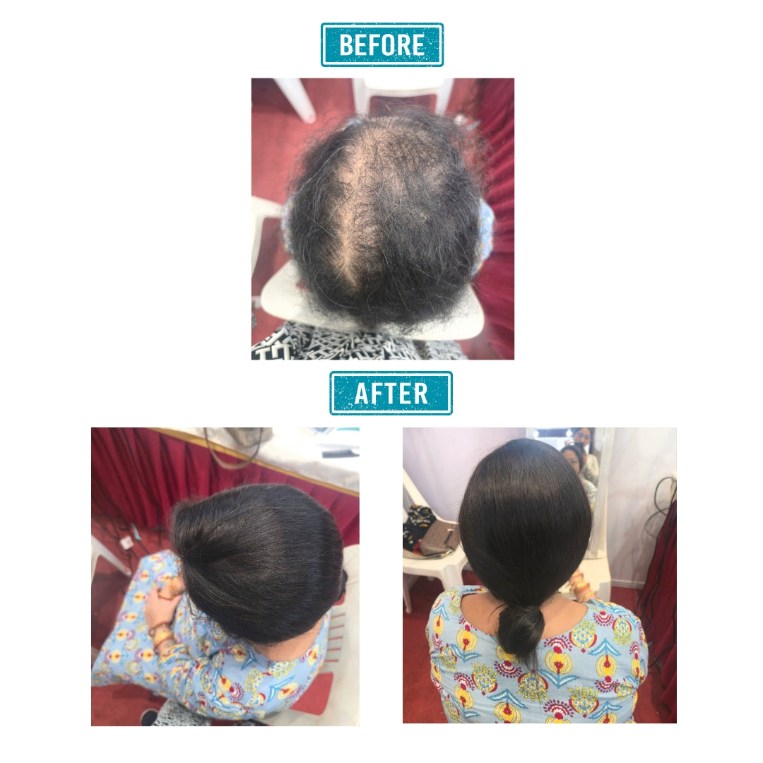 4x4 Skin Parting Topper