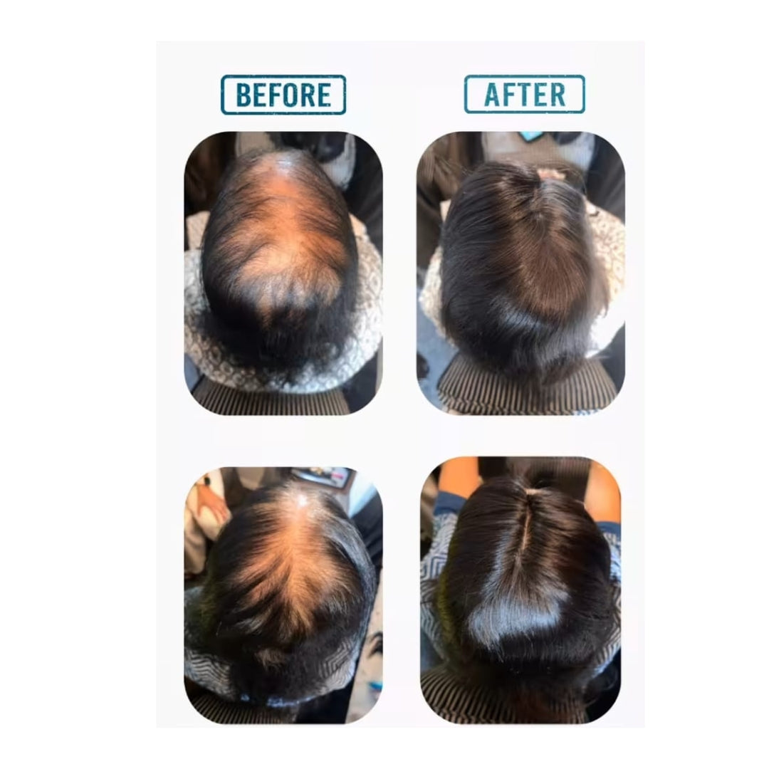 4x4 Skin Parting Topper