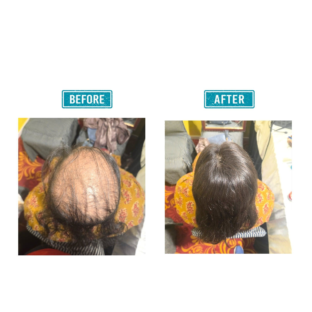 5x5 Slim Skin Topper